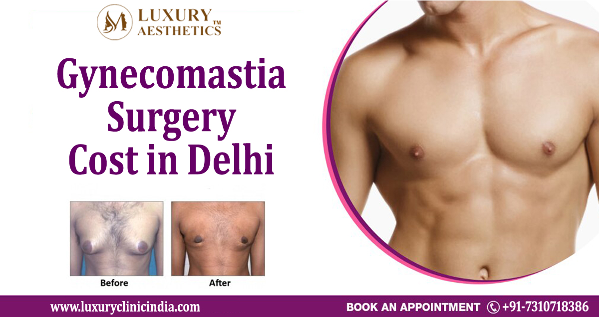 Best Cost of Gynecomastia Surgery in Delhi- luxuryclinicindia