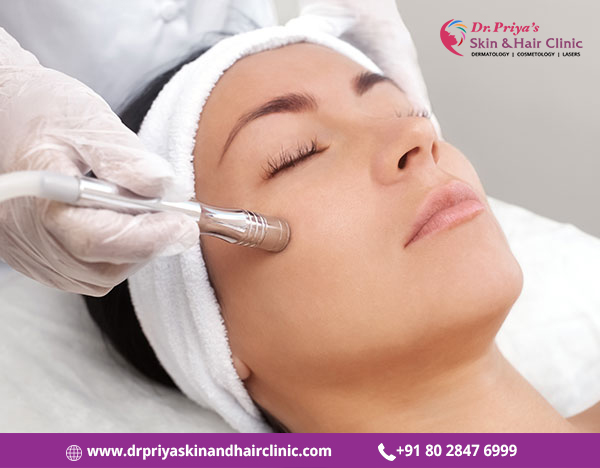 Get The Best Microdermabrasion Treatment In Marathahalli Bangalore - Dr. Priya Skin and Hair Clinic