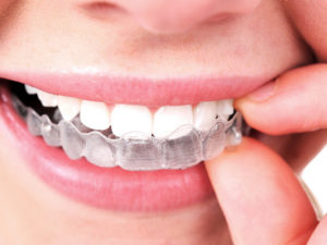 What Are Symptoms Of Abscess Tooth?