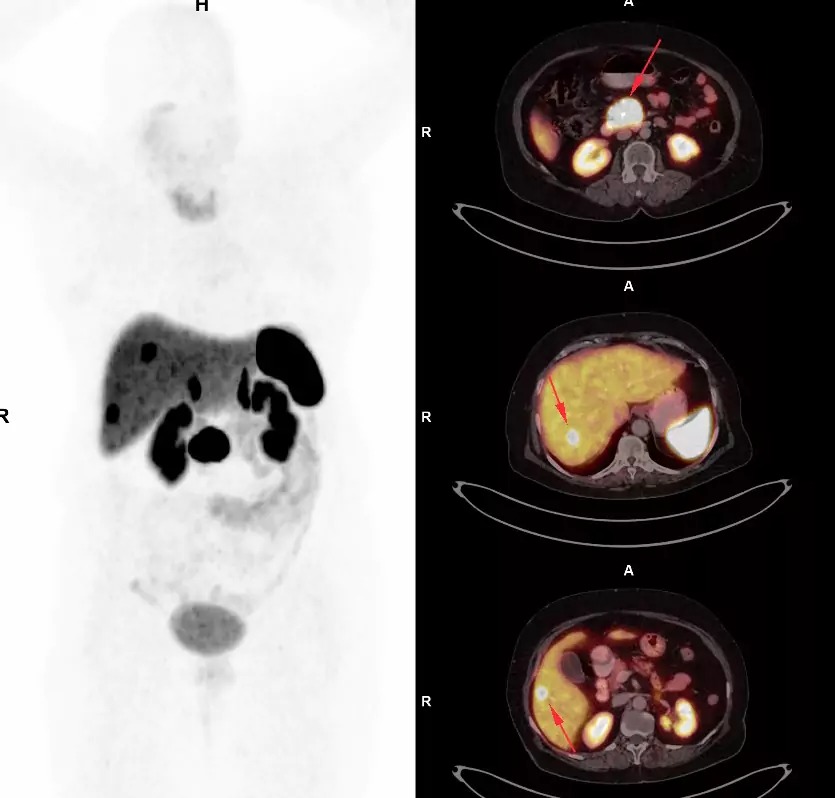 Transparent DOTA Scan Price in Mumbai – Picture This